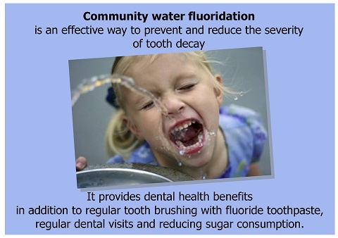 Fluoride